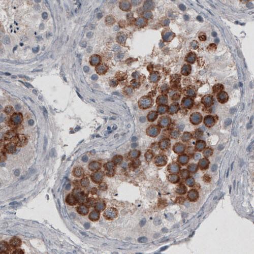 LY6K Antibody in Immunohistochemistry (Paraffin) (IHC (P))