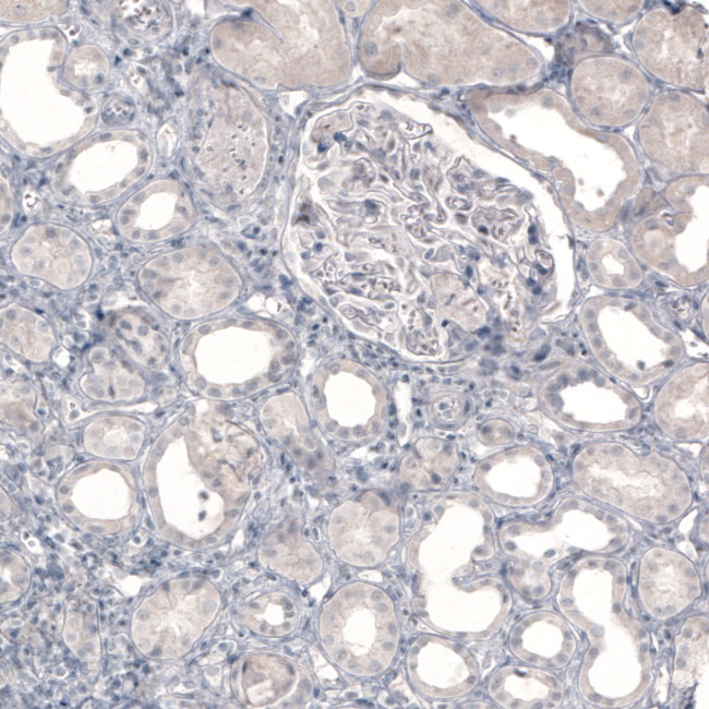 Norepinephrine Transporter Antibody in Immunohistochemistry (Paraffin) (IHC (P))