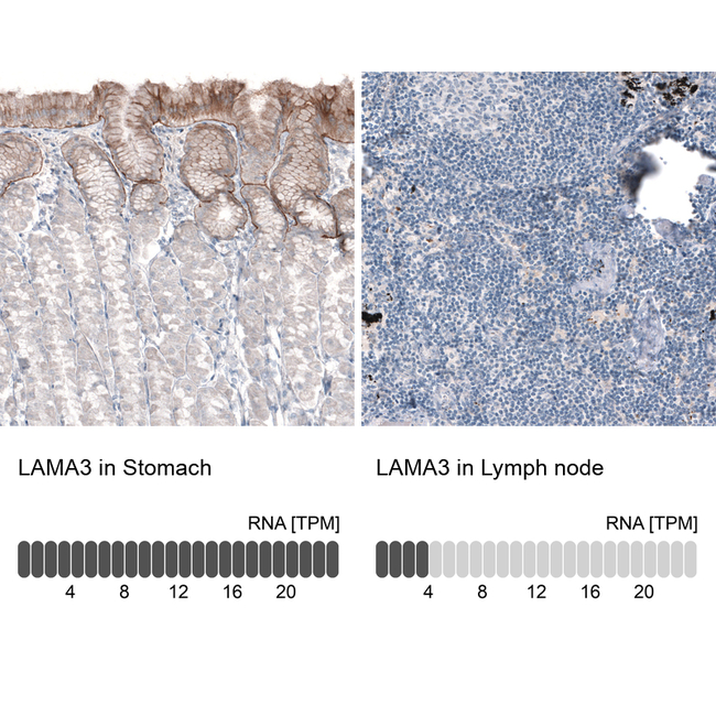 Laminin alpha-3 Antibody in Immunohistochemistry (Paraffin) (IHC (P))