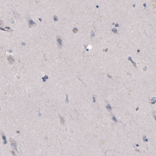 FCGRT Antibody in Immunohistochemistry (Paraffin) (IHC (P))