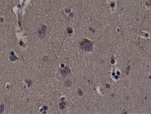 Phospho-RSK1 (Thr359, Ser363) Antibody in Immunohistochemistry (Paraffin) (IHC (P))