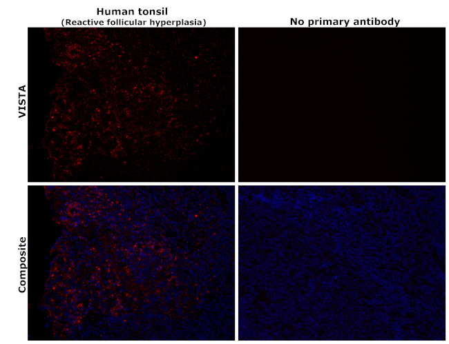 VISTA Antibody in Immunohistochemistry (Paraffin) (IHC (P))
