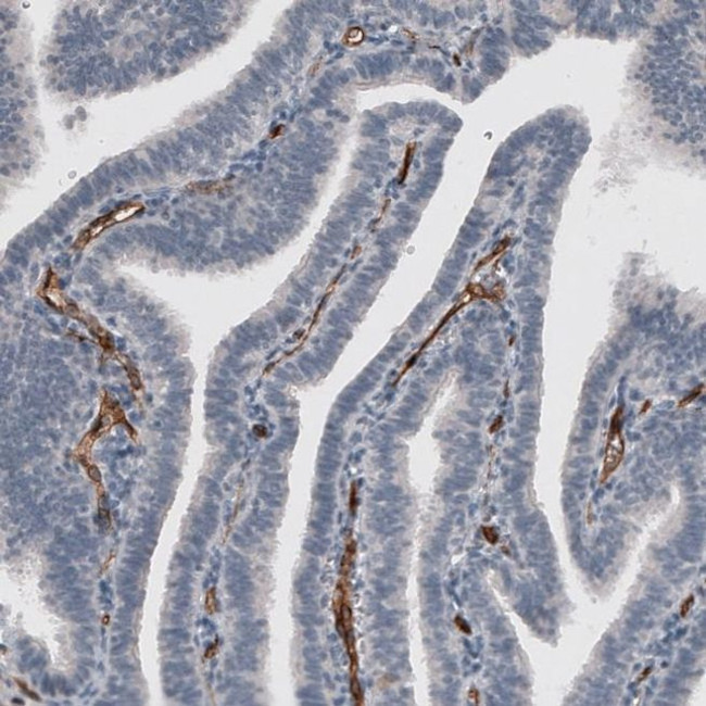 ELTD1 Antibody in Immunohistochemistry (IHC)