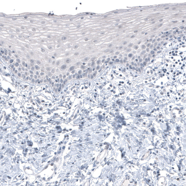 CT83 Antibody in Immunohistochemistry (IHC)
