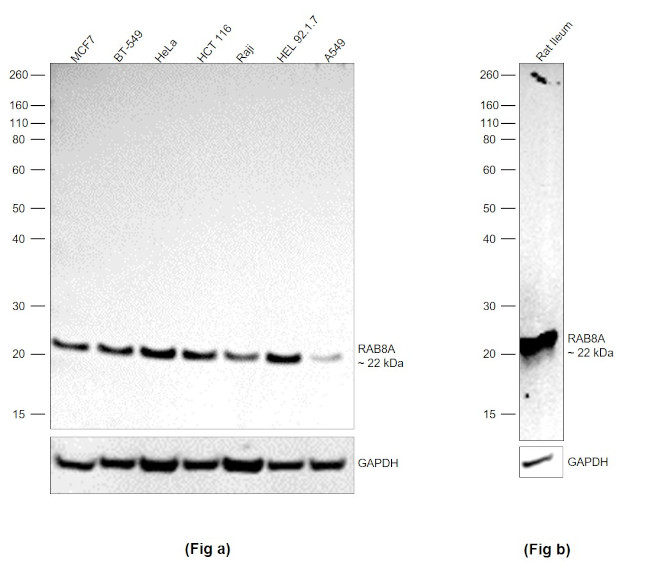 RAB8A Antibody in Western Blot (WB)