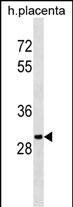 OR5B12 Antibody in Western Blot (WB)
