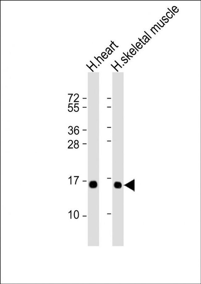 TUSC2 Antibody in Western Blot (WB)