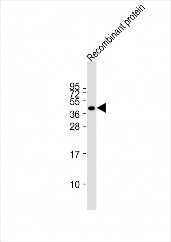 FAT4 Antibody in Western Blot (WB)