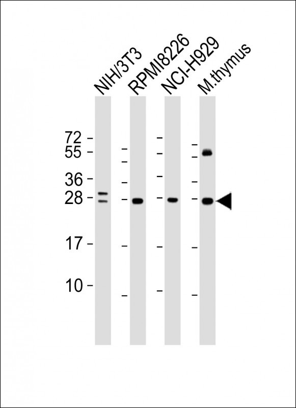 FGFR1OP2 Antibody in Western Blot (WB)