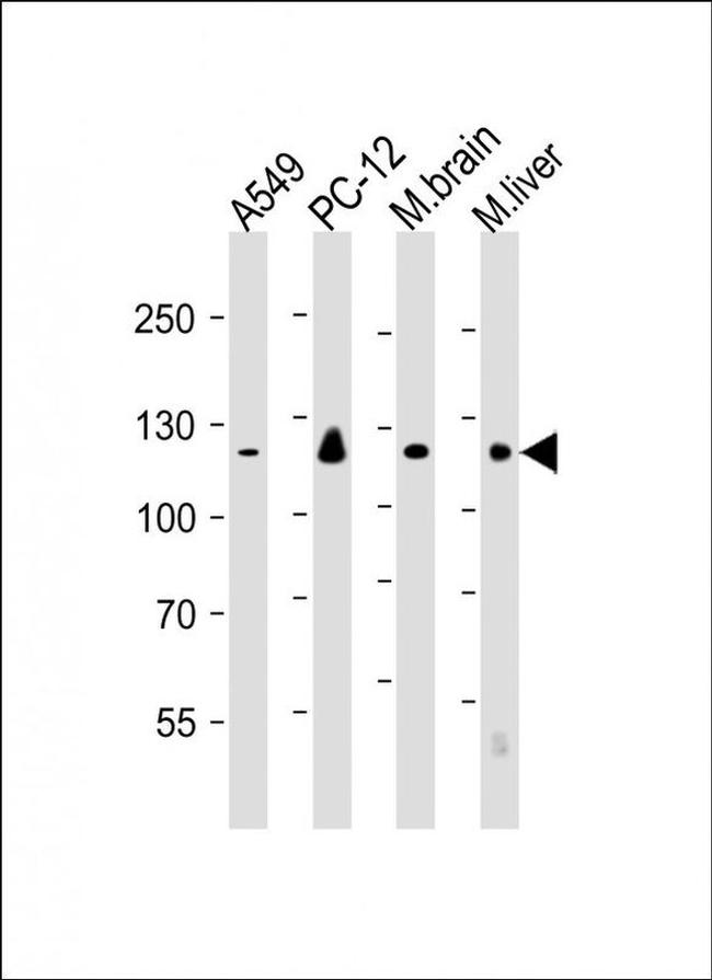 PERK Antibody in Western Blot (WB)