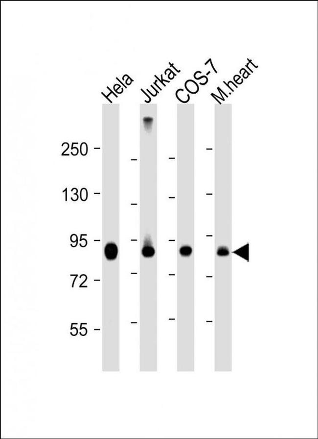 PFKP Antibody in Western Blot (WB)