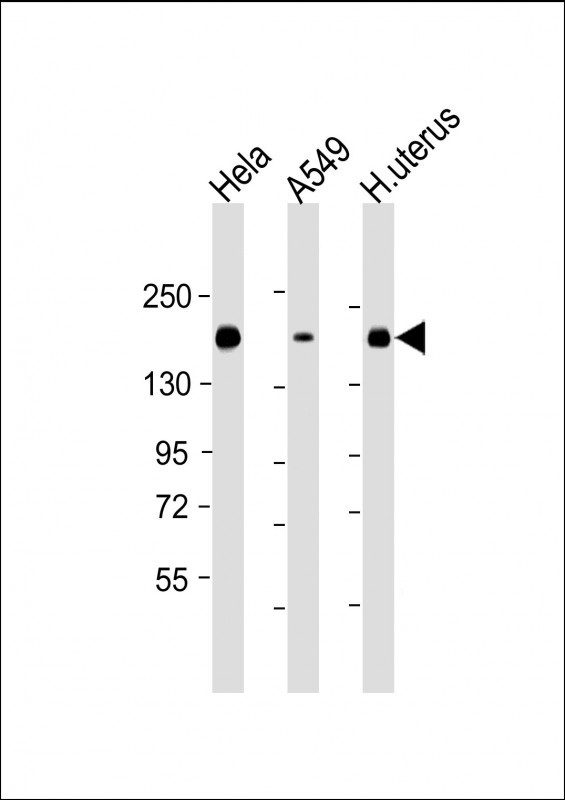 ITGA11 Antibody in Western Blot (WB)
