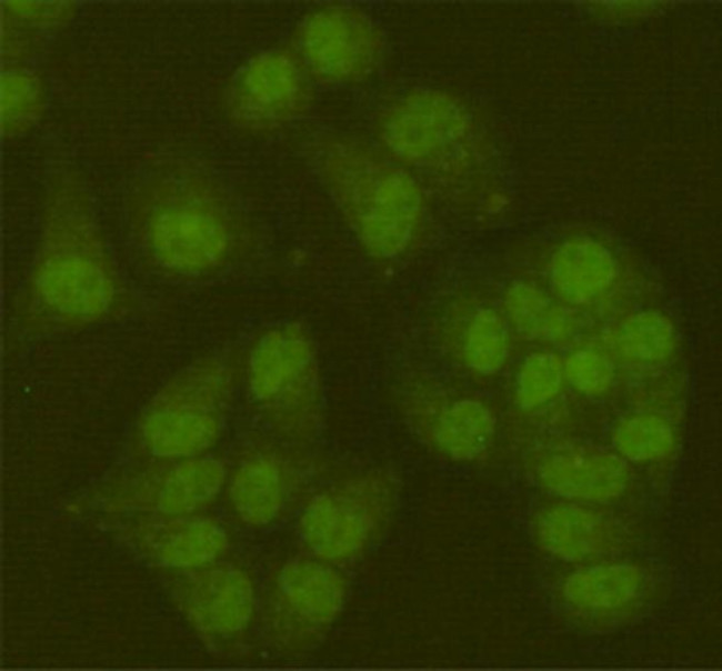 SIRT6 Antibody in Immunocytochemistry (ICC/IF)