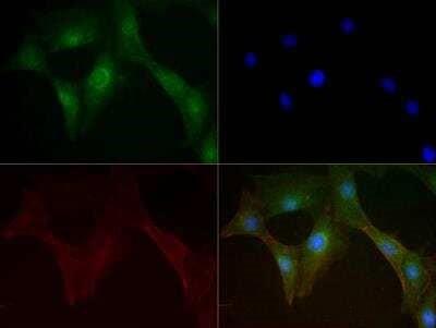 MFN1 Antibody in Immunocytochemistry (ICC/IF)