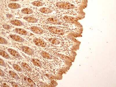TCCR Antibody in Immunohistochemistry (Paraffin) (IHC (P))