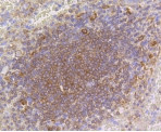 ARPC5 Antibody in Immunohistochemistry (Paraffin) (IHC (P))