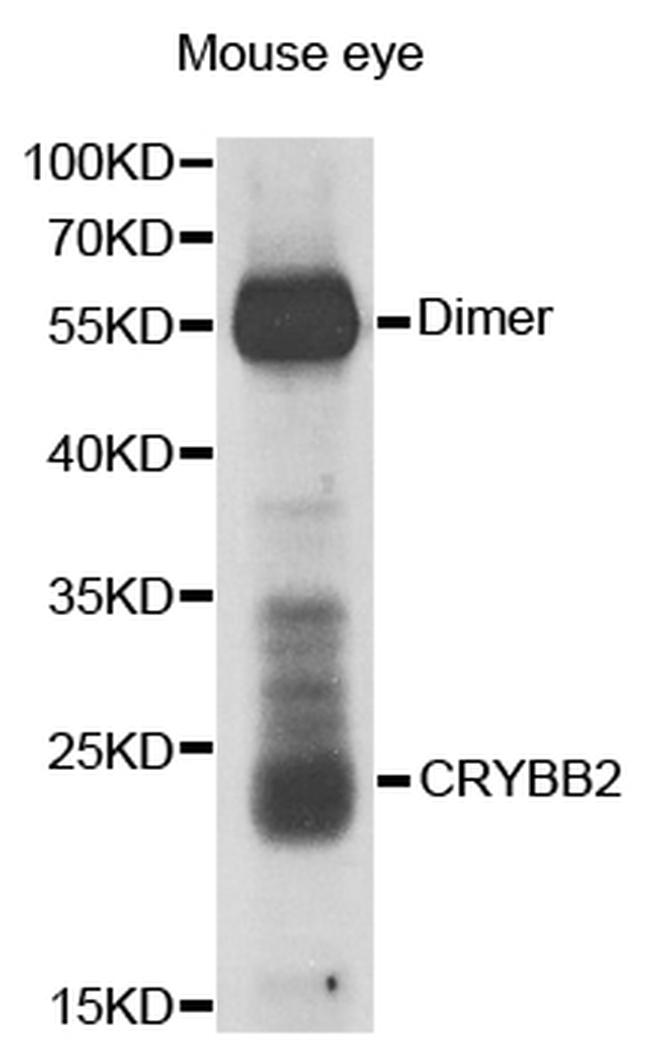 CRYBB2 Antibody in Western Blot (WB)