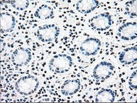 CNDP1 Antibody in Immunohistochemistry (Paraffin) (IHC (P))