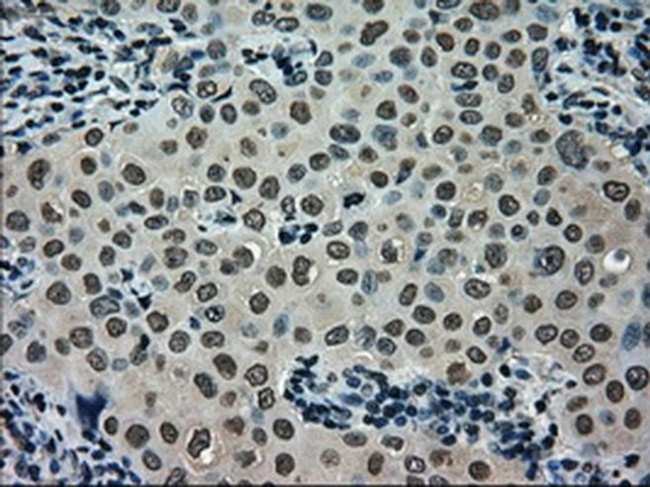 SCYL3 Antibody in Immunohistochemistry (Paraffin) (IHC (P))