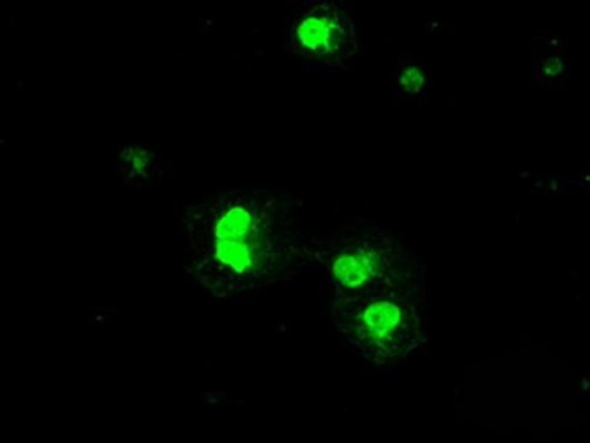 PRKY Antibody in Immunocytochemistry (ICC/IF)