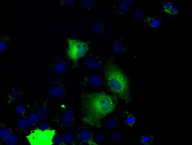 PRKY Antibody in Immunocytochemistry (ICC/IF)