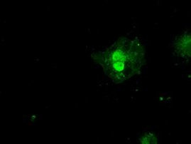SSX2 Antibody in Immunocytochemistry (ICC/IF)