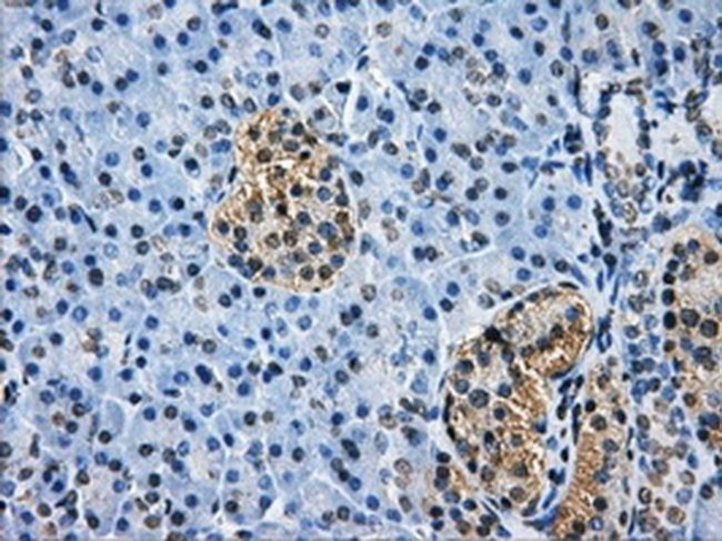 HDAC10 Antibody in Immunohistochemistry (Paraffin) (IHC (P))