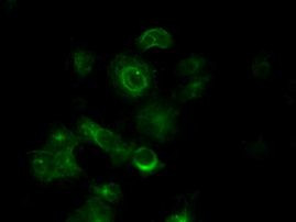TUBA8 Antibody in Immunocytochemistry (ICC/IF)