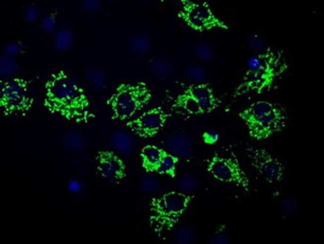 RF1ML Antibody in Immunocytochemistry (ICC/IF)