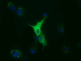 TUBA8 Antibody in Immunocytochemistry (ICC/IF)