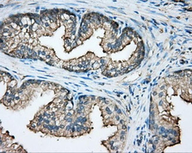 CAPZA1 Antibody in Immunohistochemistry (Paraffin) (IHC (P))