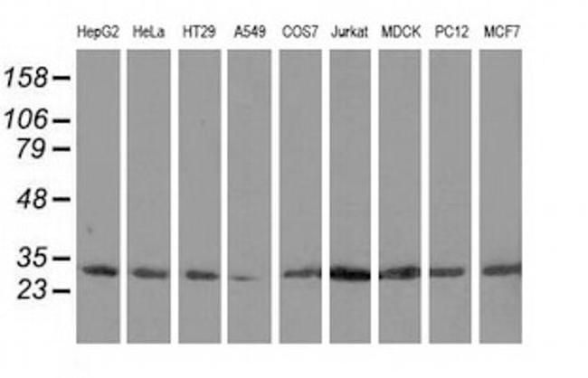 CAPZA1 Antibody in Western Blot (WB)