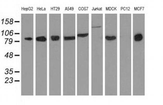 DGKB Antibody in Western Blot (WB)