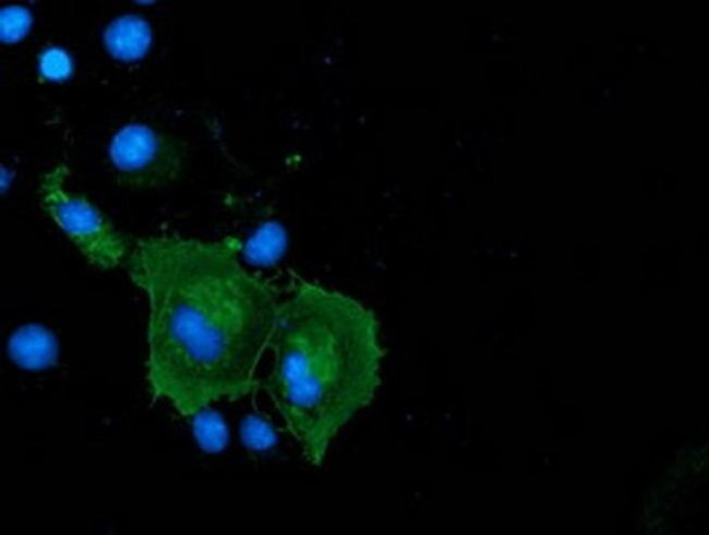 Coronin 1A Antibody in Immunocytochemistry (ICC/IF)