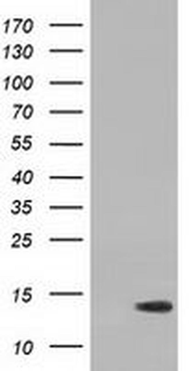 RIPPLY2 Antibody in Western Blot (WB)