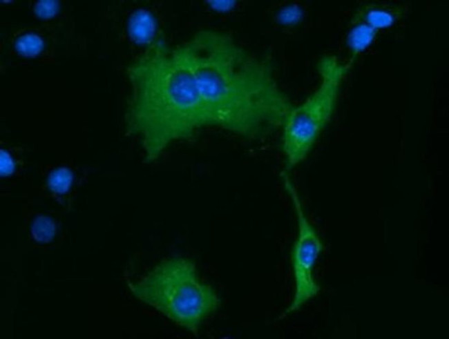 KLHL2 Antibody in Immunocytochemistry (ICC/IF)