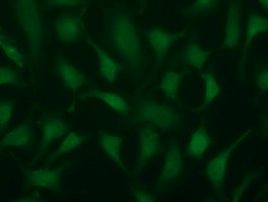 TRIM2 Antibody in Immunocytochemistry (ICC/IF)