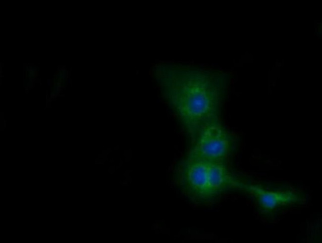 CBWD1 Antibody in Immunocytochemistry (ICC/IF)
