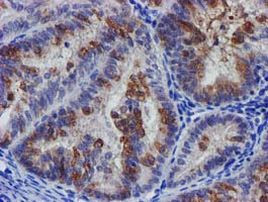 SLFNL1 Antibody in Immunohistochemistry (Paraffin) (IHC (P))