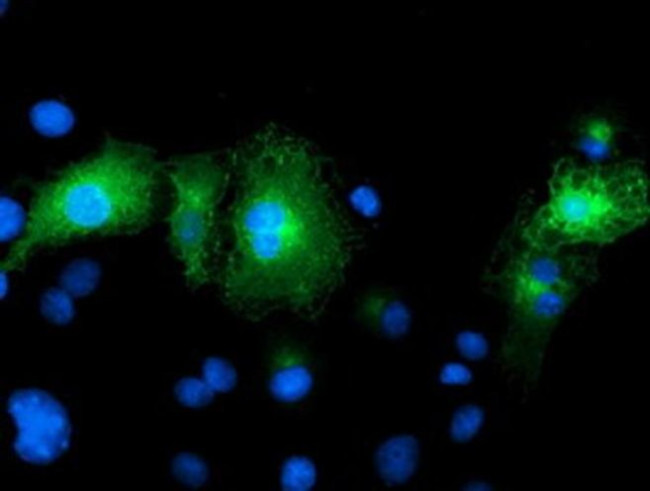 FAM84B Antibody in Immunocytochemistry (ICC/IF)