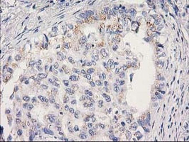 MRPS2 Antibody in Immunohistochemistry (Paraffin) (IHC (P))