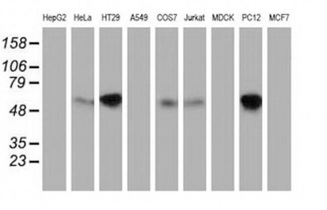 EXD1 Antibody in Western Blot (WB)