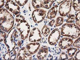 MMAA Antibody in Immunohistochemistry (Paraffin) (IHC (P))