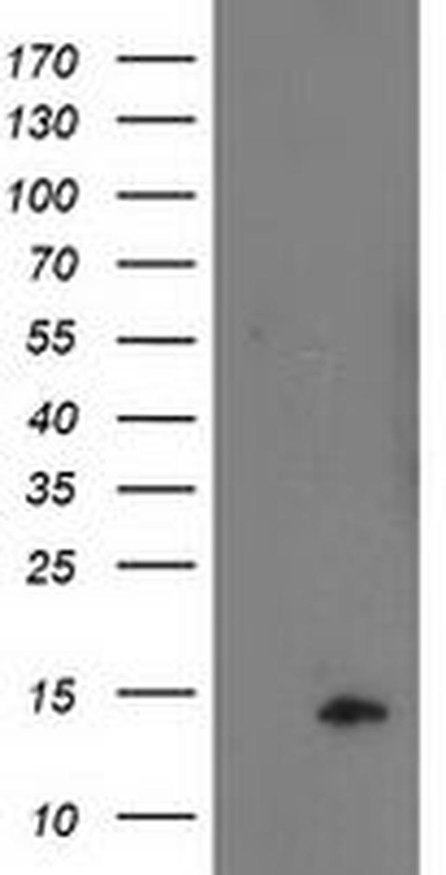 POLR2J2 Antibody in Western Blot (WB)