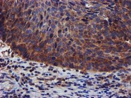 PIH1D2 Antibody in Immunohistochemistry (Paraffin) (IHC (P))