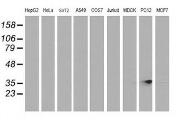 RDH14 Antibody in Western Blot (WB)