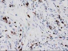 S100A12 Antibody in Immunohistochemistry (Paraffin) (IHC (P))