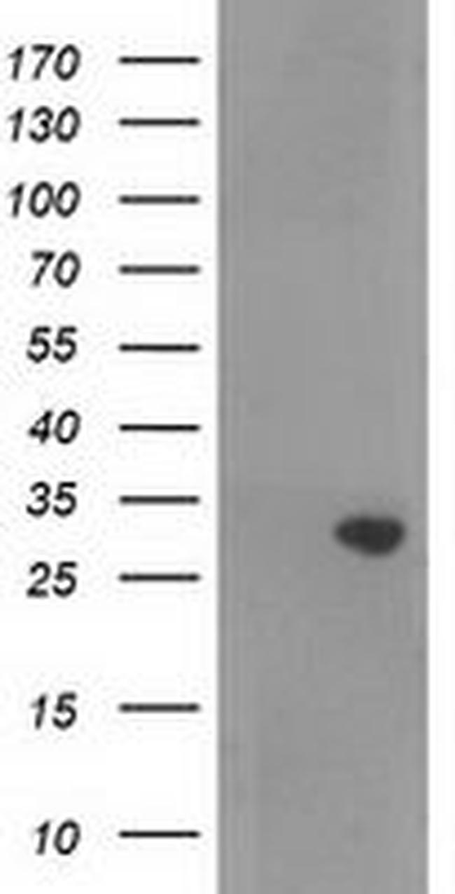 NORE1 Antibody in Western Blot (WB)