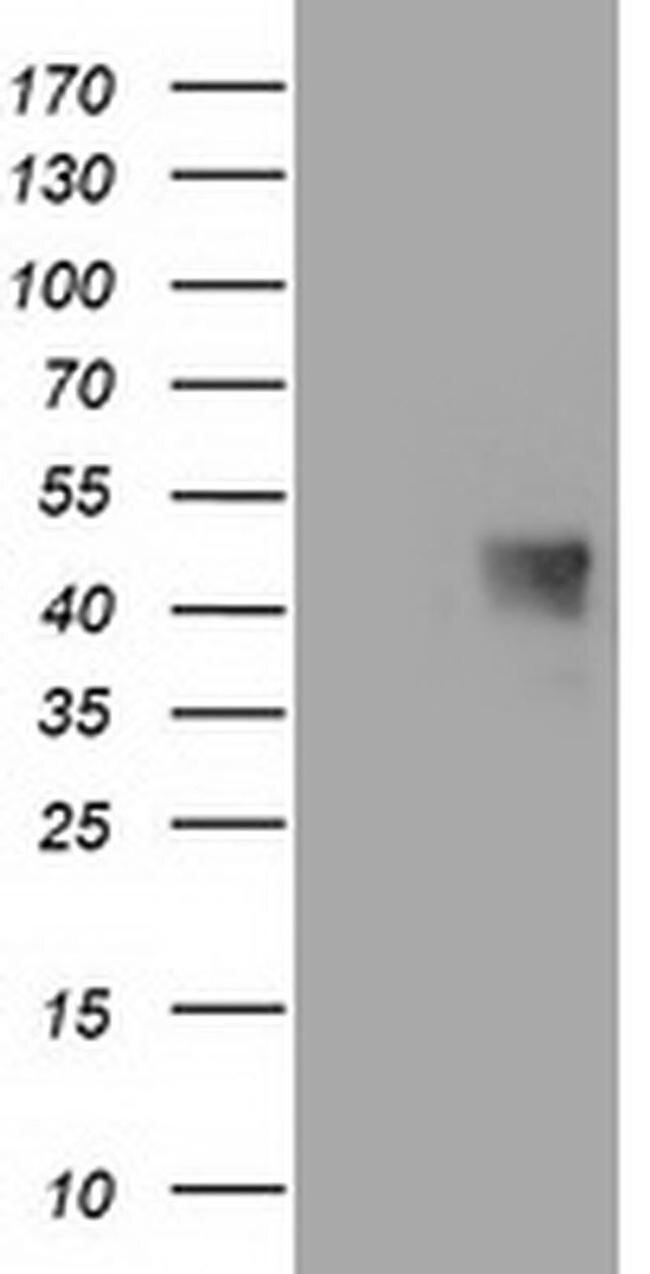 MAB21L3 Antibody in Western Blot (WB)