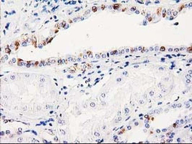 ITM2B Antibody in Immunohistochemistry (Paraffin) (IHC (P))